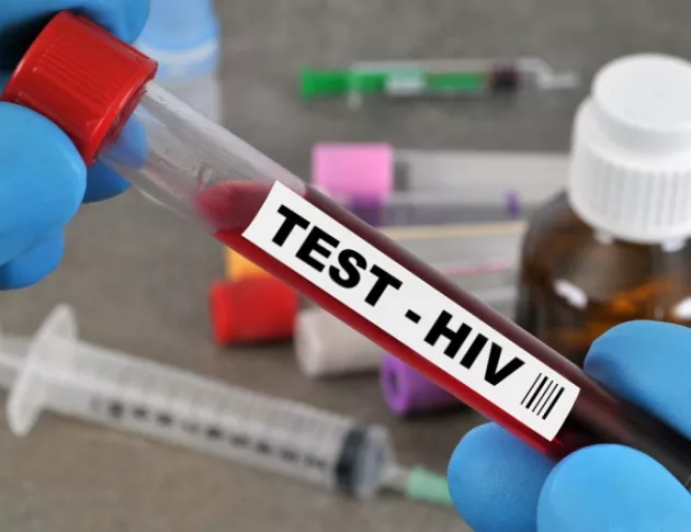 Ще има изпитания на ваксина срещу ХИВ върху хора