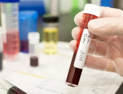 Пациентите с ХИВ отново са в риск заради спряно вирусологично проследяване