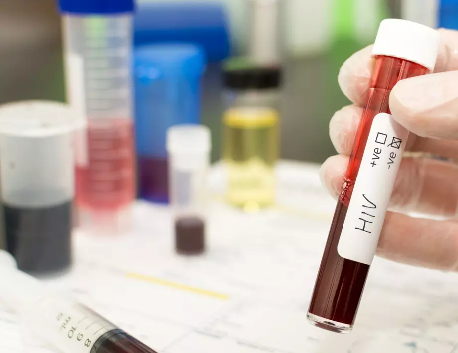 "Дюселдорфският пациент": лечим ли е вече СПИН?