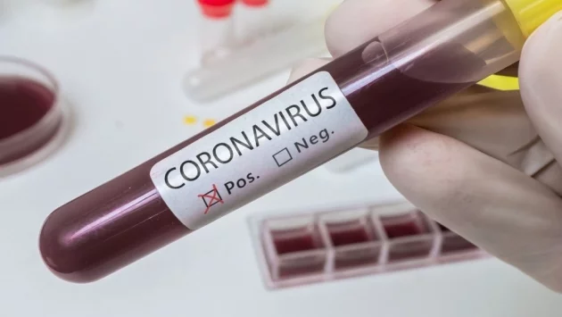 Няма нови установени случаи на коронавирус у нас към 17 часа, изследват се всички контактни на заразените лица