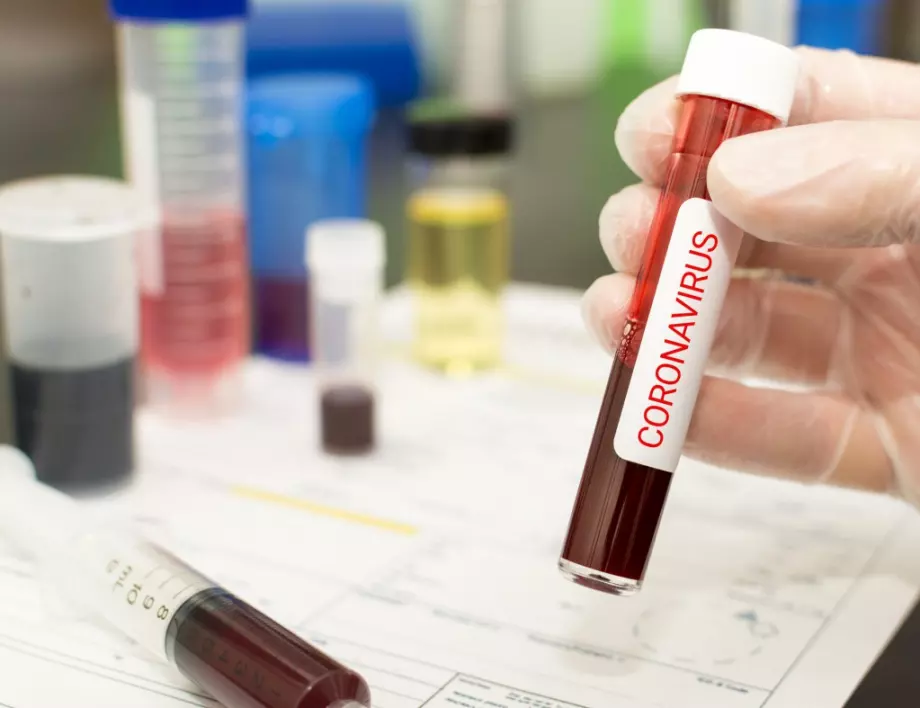 Пациентът в Плевен със съмнение за коронавирус също не изглежда с рисков профил