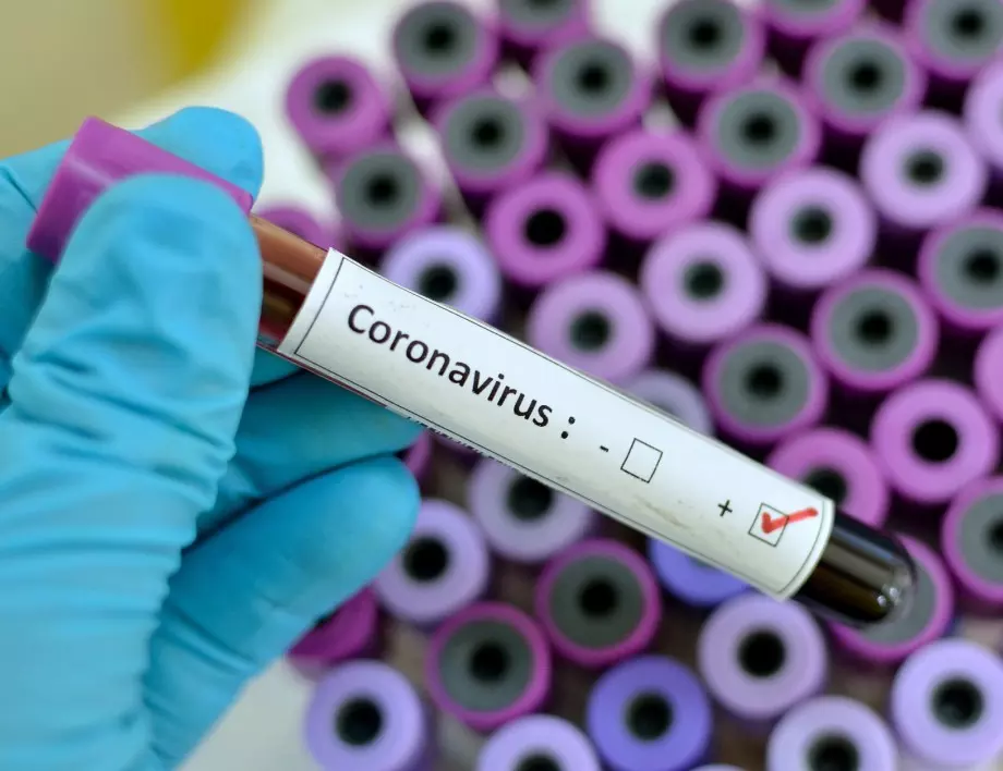 75 нови случая на коронавирус у нас