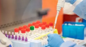 Президентът на Сръбската футболна асоциация също е заразен с коронавирус 