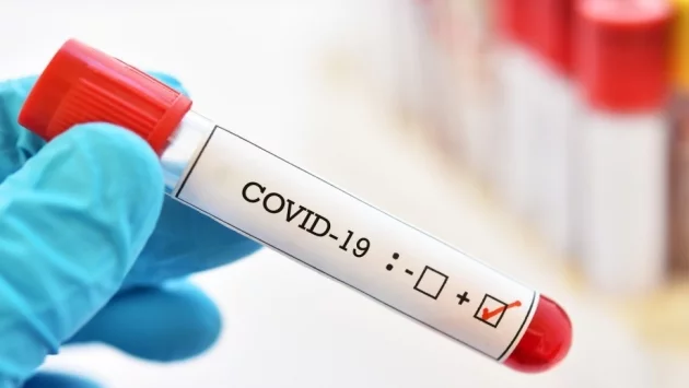 Над 1000 са вече заразените с коронавирус в Сърбия