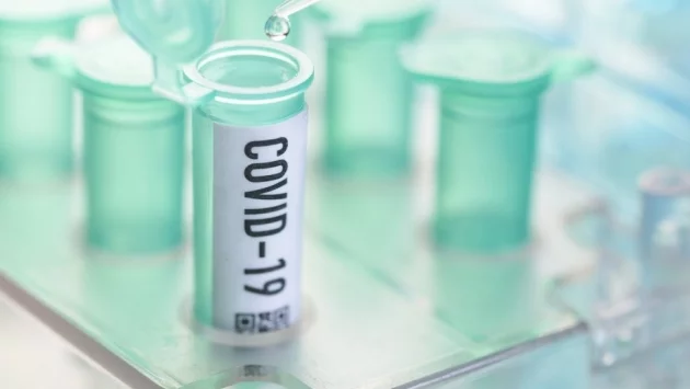 Кога светът да очаква ваксина срещу коронавируса?  