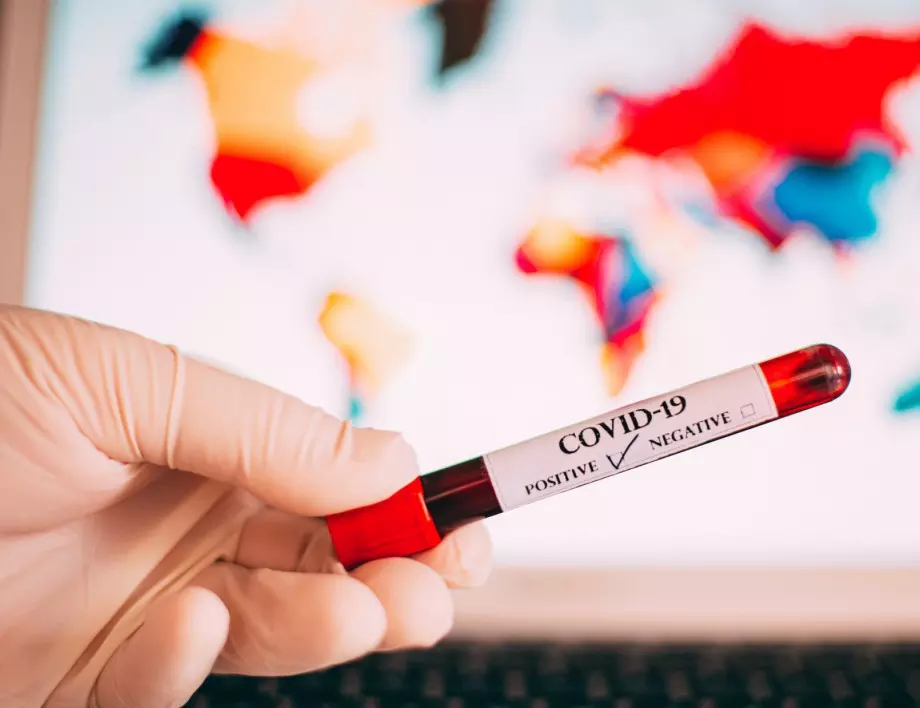 Заразените с коронавирус надминаха 400 000 души в световен мащаб