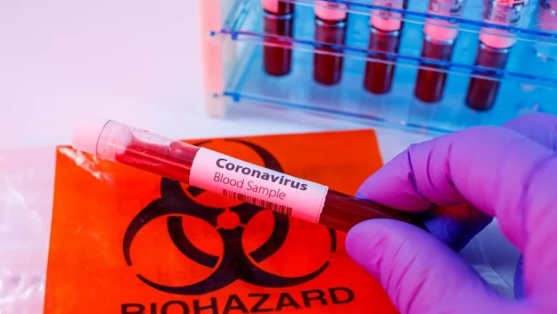 253-ма заразени от коронавирус в Словения  