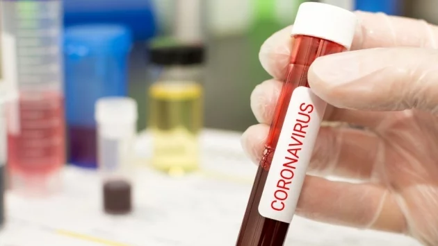 Втора жертва на коронавируса в Албания 