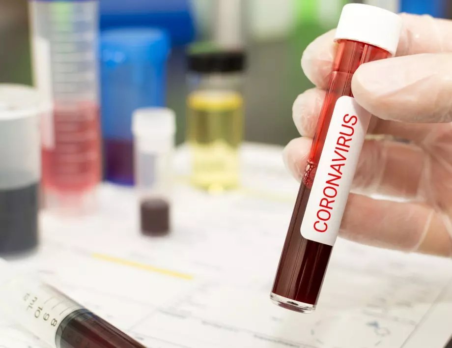 Daily mail: Британското правителство не изключва вероятност за изтичане на коронавируса от лаборатория