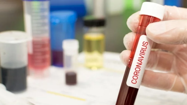 Кметът на Скопие е с коронавирус 