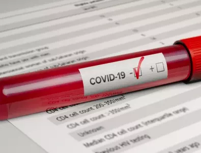 Проф. Аргирова: Бързите тестове за коронавирус – резултатни са при определени условия