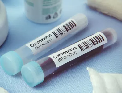 Загубата на обоняние - симптом, свързан с коронавирус 