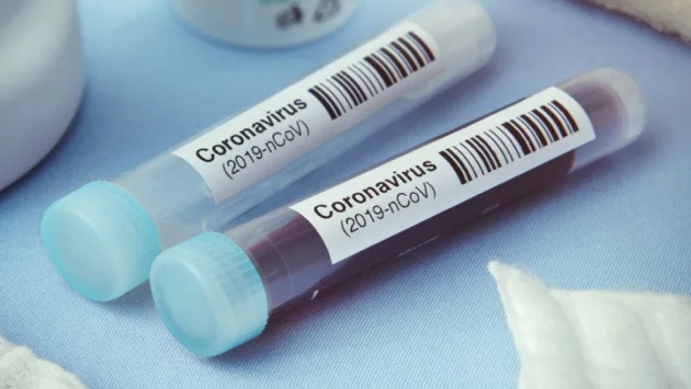 Мъж с коронавирус почина в Кюстендил