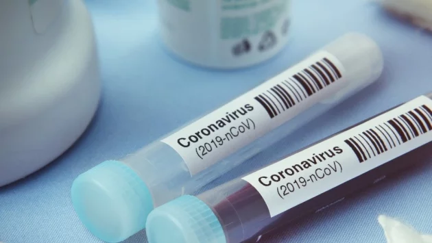 503 са вече доказаните случаи на коронавирус у нас