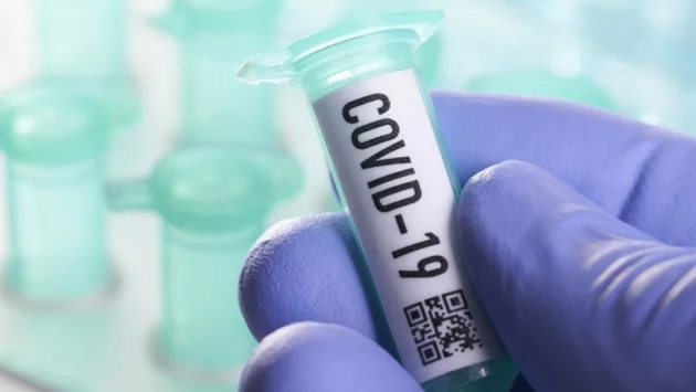  Първи смъртен случай от коронавирус в Русия 