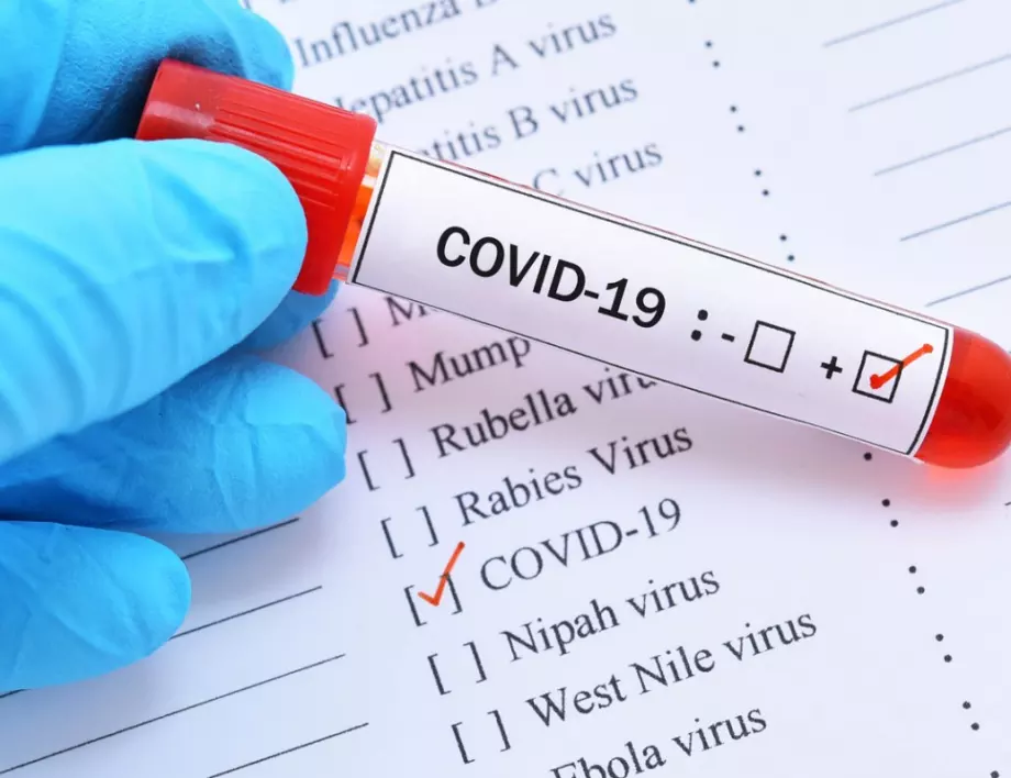 Една положителна проба за коронавирус днес в лабораторията в Стара Загора