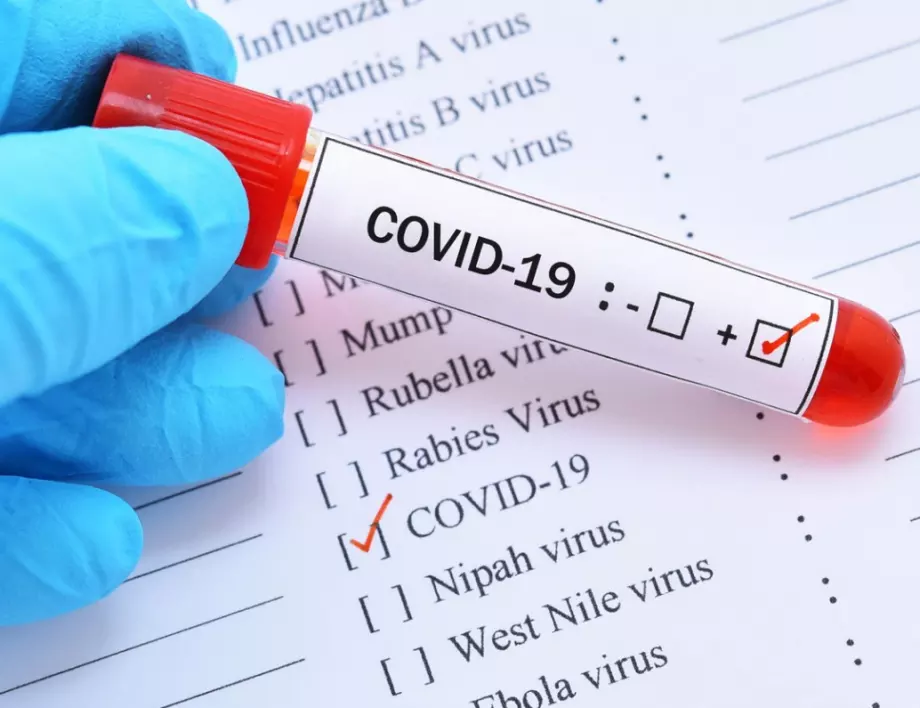 Нов случай на заразен с коронавирус в Бургас