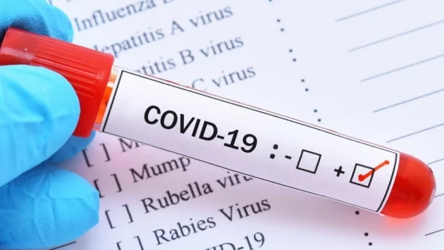 Равносметка: 550 000 са заразените и над 25 000 са починалите от коронавирус по света 