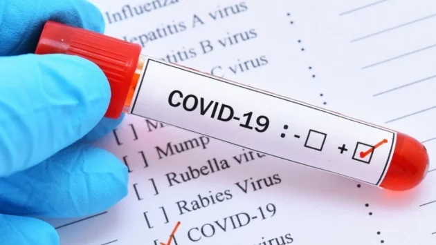 Не, коронавирусът не е създаден в лаборатория