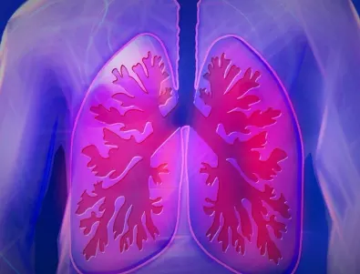 Какво представлява възпалението на белите дробове?