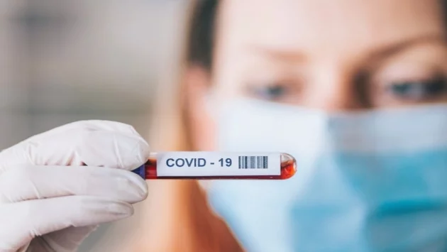 Покъртително: Лицата на медиците, борещи се с COVID-19 (СНИМКИ)