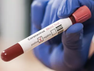 Твърдение от Русия: Има тестове, които хващат коронавируса преди поява на симптоми