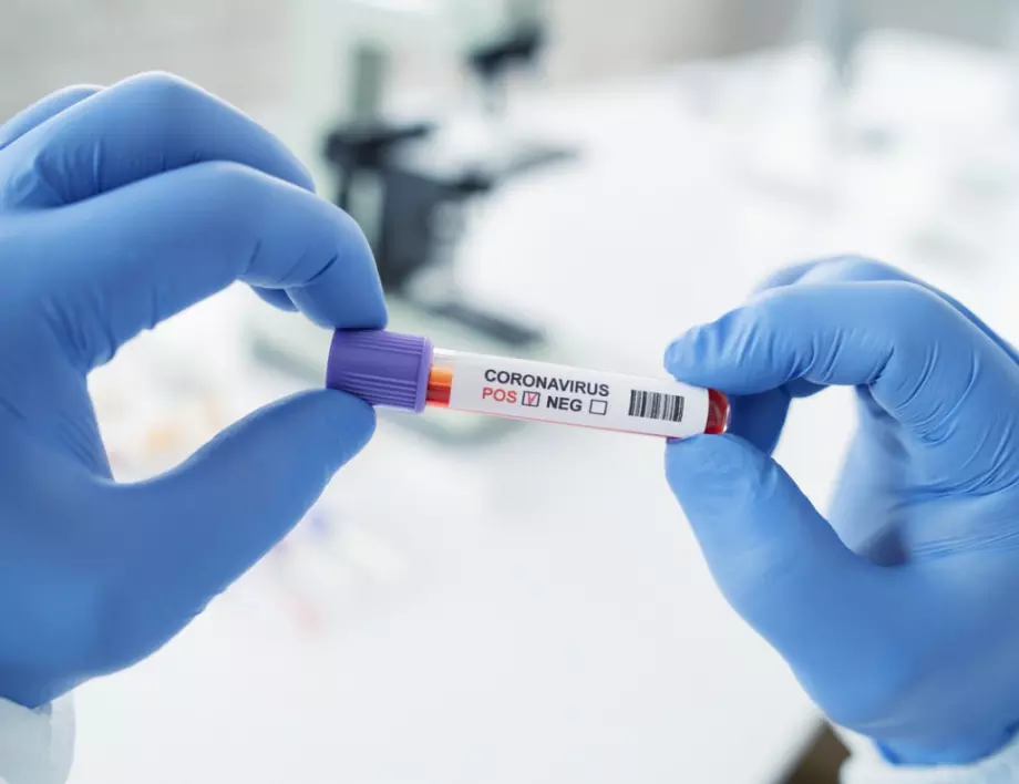 Направи си безплатен онлайн тест за коронавирус