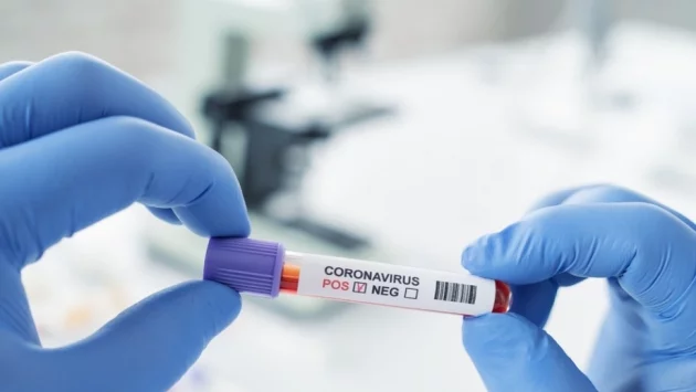 Новите три случая на коронавирус във Велико Търново са без симптоми