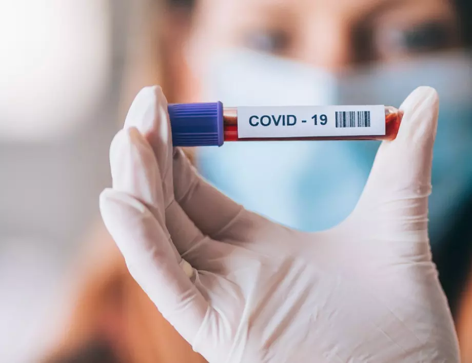 Първи руски бърз тест за коронавирус отива в Европа, Азия и САЩ 