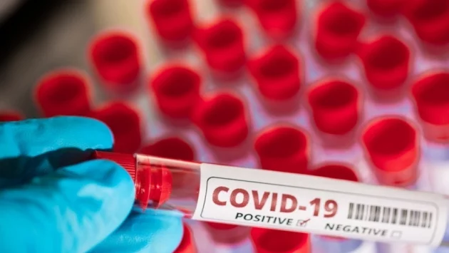 Учени: COVID-19 няма да изчезне при затопляне на времето  