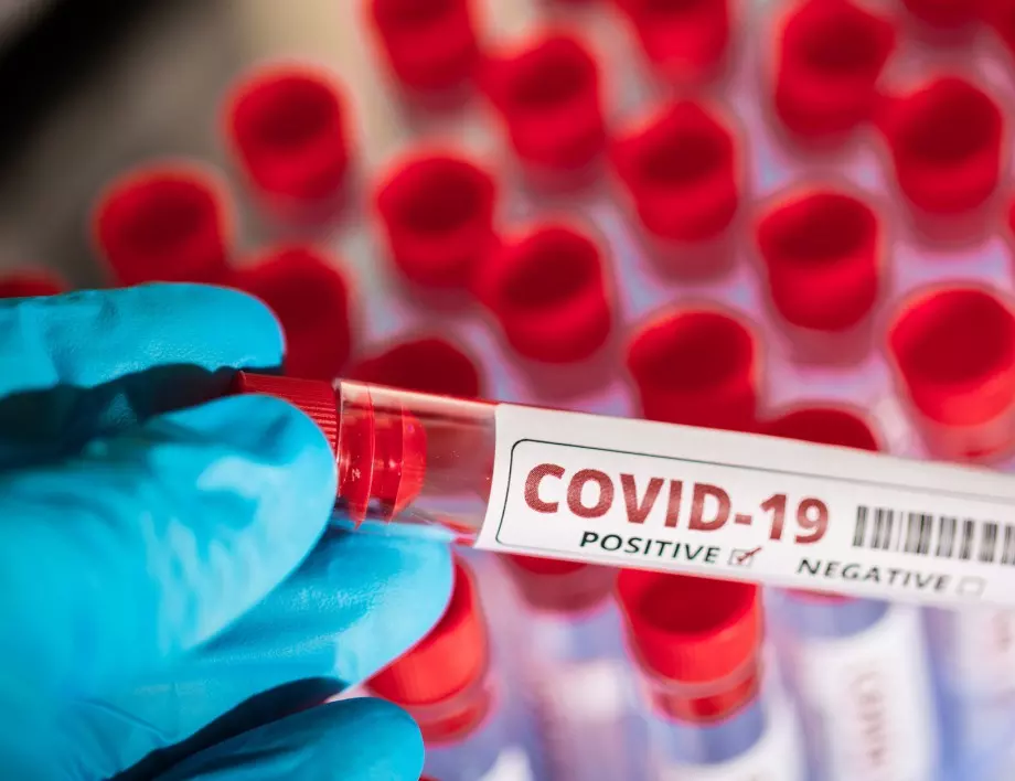 Фонд „Научни изследвания“ търси учени с разработки за коронавируса  