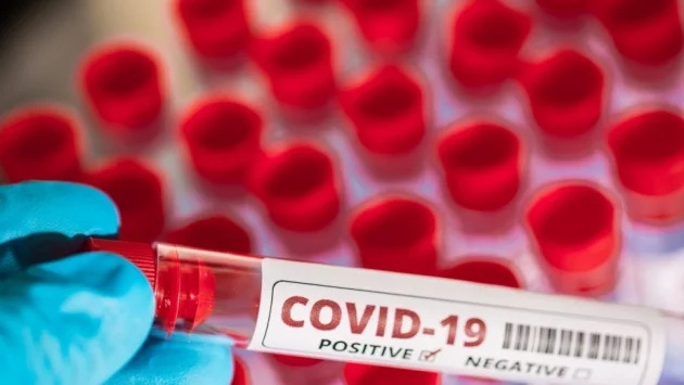 Служител на "Социален патронаж" и двама доброволци в БЧК са с COVID-19 