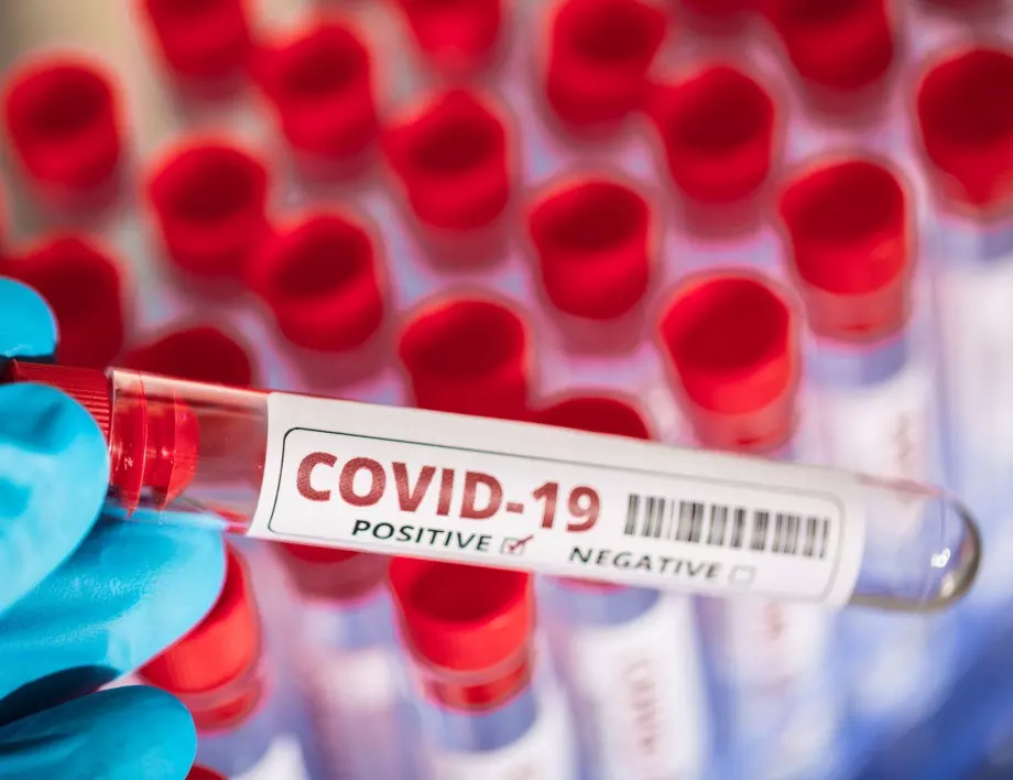 Около 70 ваксини срещу коронавирус са в процес на разработка