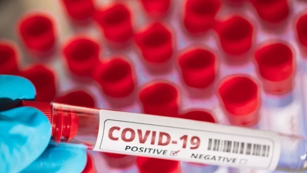 21 души са излекувани от COVID-19 за последното денонощие