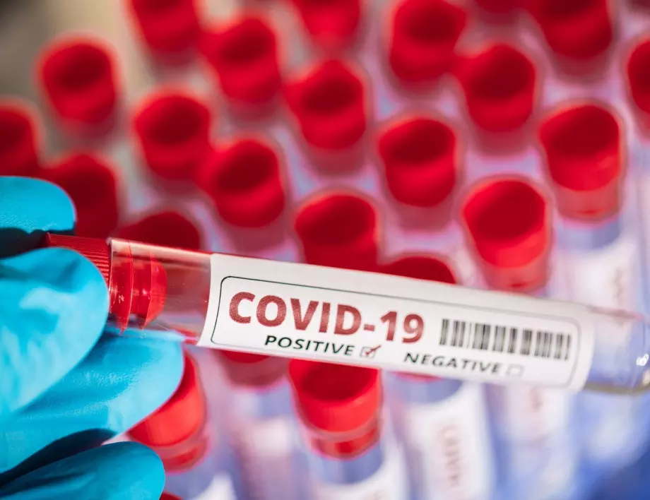 21 души са излекувани от COVID-19 за последното денонощие