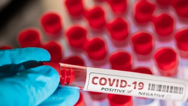 Вирусолог: Все още няма потвърждение за по-лек вариант на COVID-19