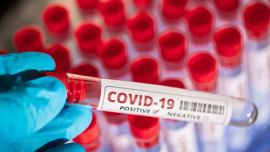 92 са новите случаи на COVID-19 у нас