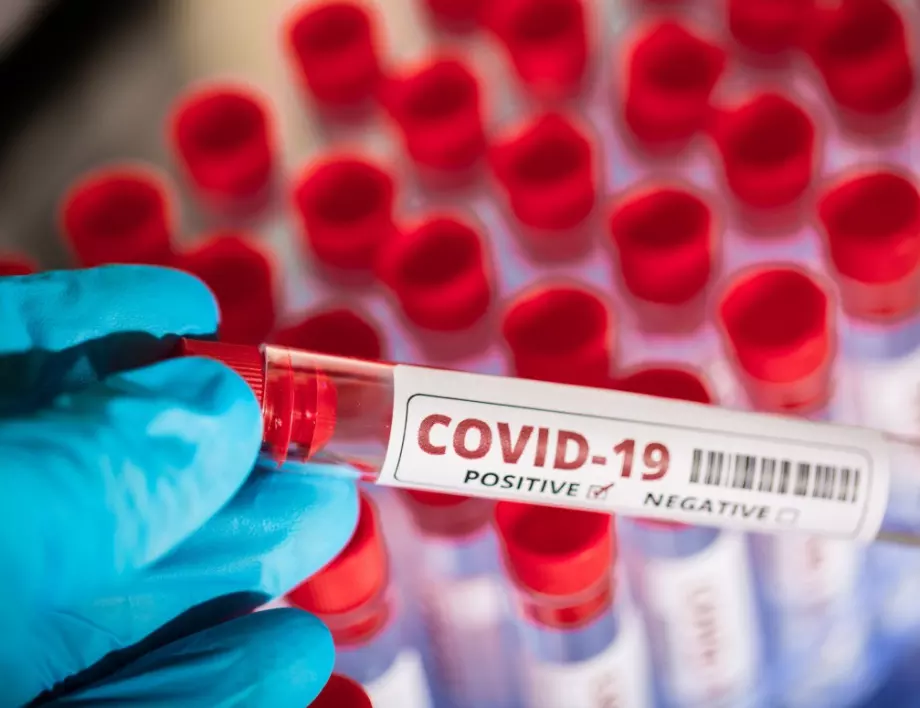 92 са новите случаи на COVID-19 у нас