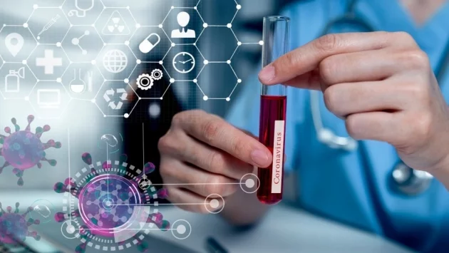 Държавата купува още 42 000 PCR теста за COVID-19