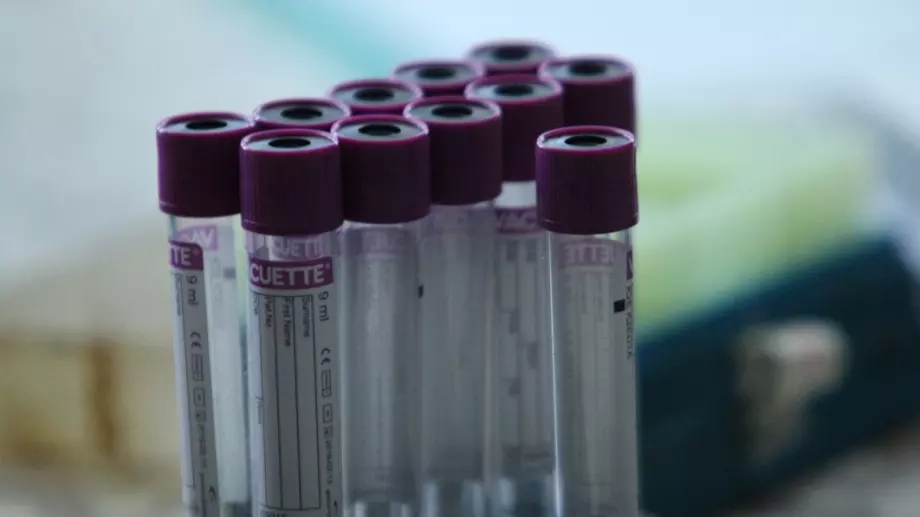 Започват мащабни изпитания на кръвен тест за 50 вида рак