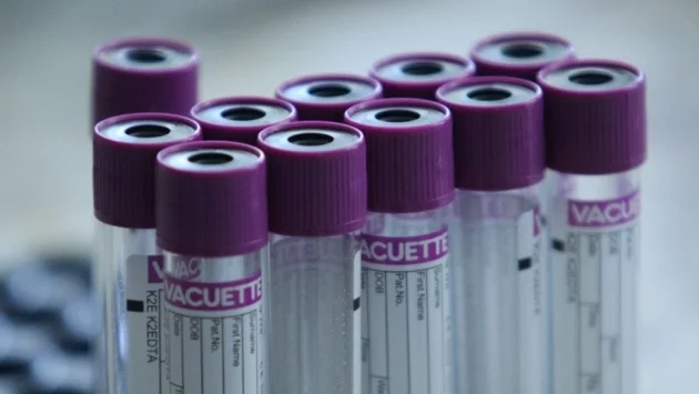 Според сръбски лекар страната е достигнала началото на края на епидемията, но е далече от края 