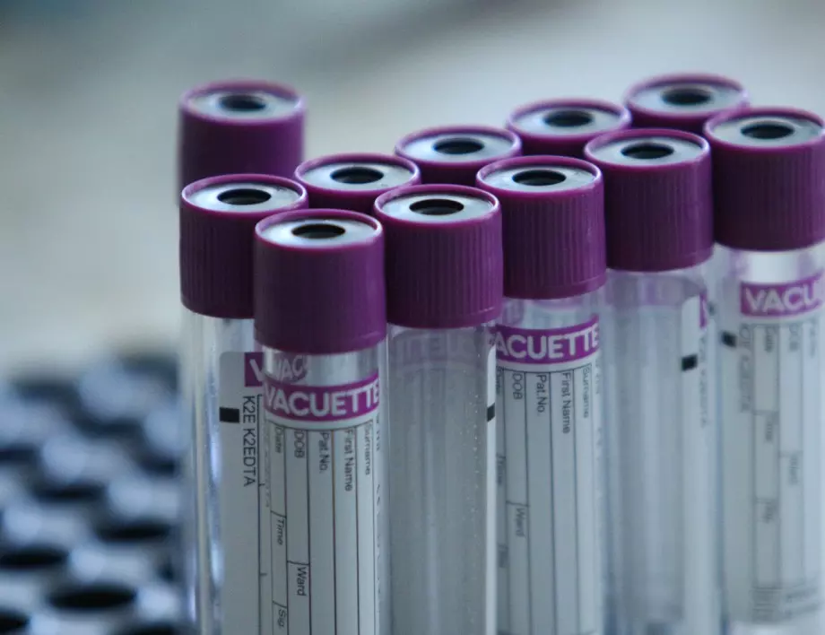 МЗ: PCR тест, заплатен от гражданите, не може да бъде условие за прием в лечебни заведения