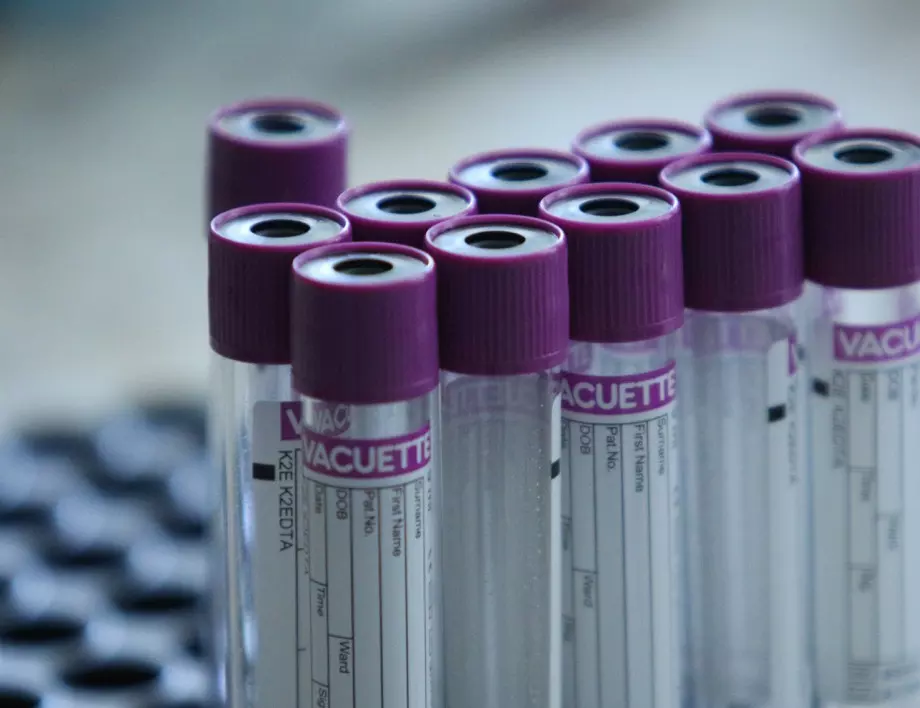 Сигнали: Болници задължават пациенти да правят PCR тест за тяхна сметка 