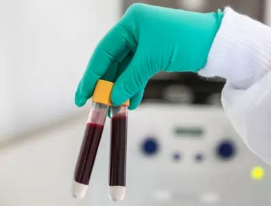 Коварството на тестовете за коронавирус