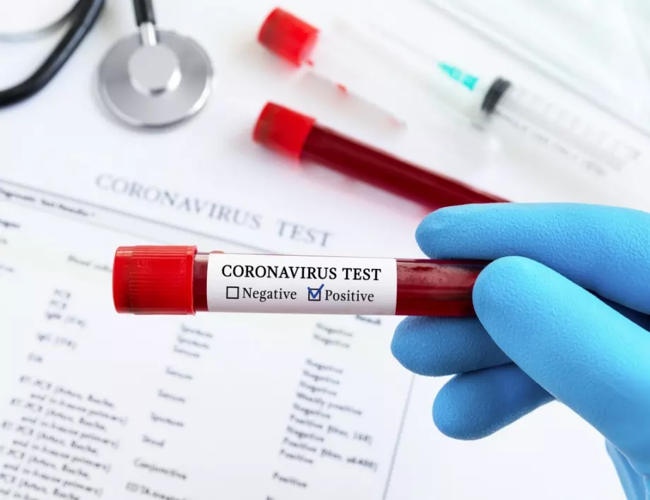 Ден с над 300 случая на коронавирус в България, голям брой случаи извън София