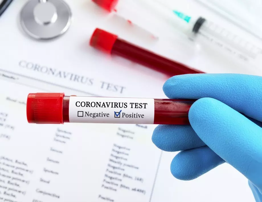 Статистика от СЗО: Повече от 353 000 заразени с коронавирус на ден