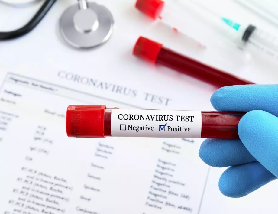 Отново голям брой заразени с коронавирус, близо 20 на сто от пробите са положителни