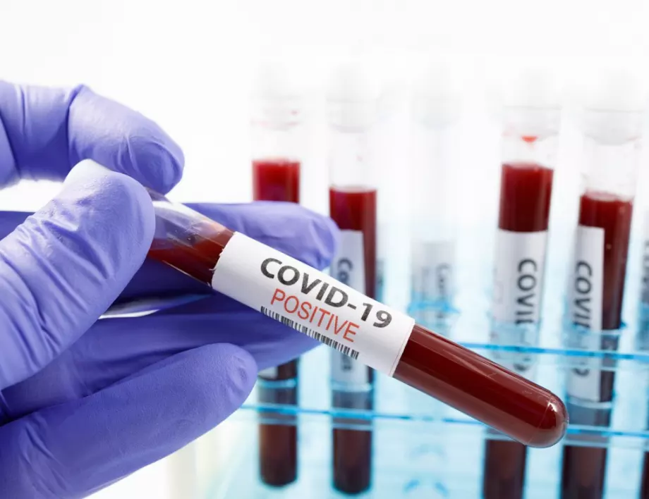 Случаите във Варна вдигнаха процента на заразени с коронавирус в България