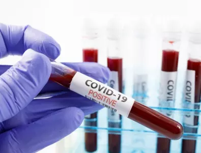САЩ одобриха нов тест за COVID-19 