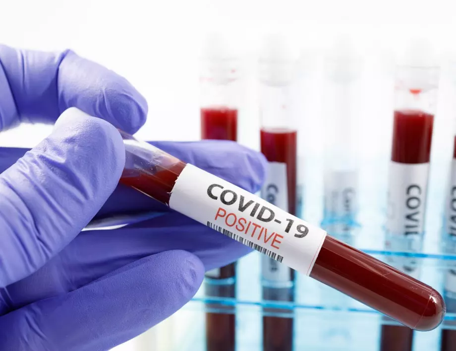 Откриха бърз начин за измерване на имунния отговор срещу COVID-19